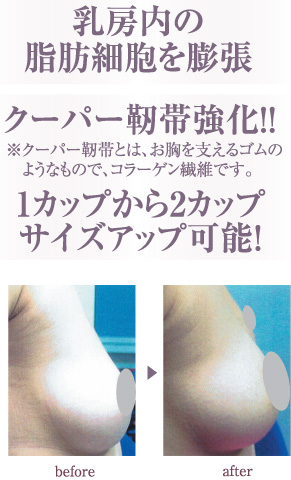 �Х��ȥ��åץ�����