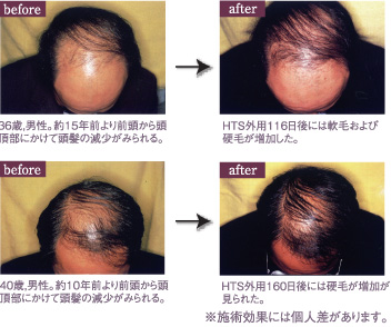 ���ӥ�����